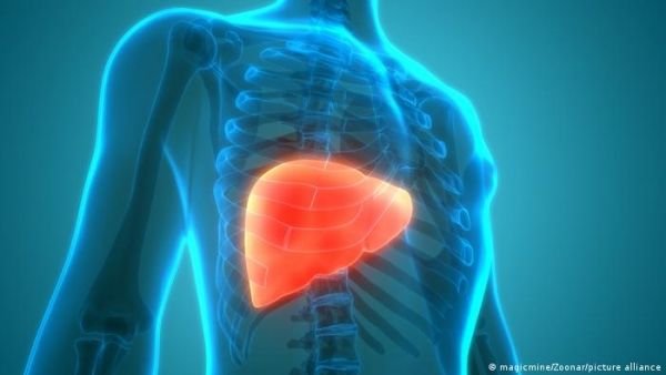 دراسة: الكبد الدهني يزيد من خطر الإصابة بالخرف