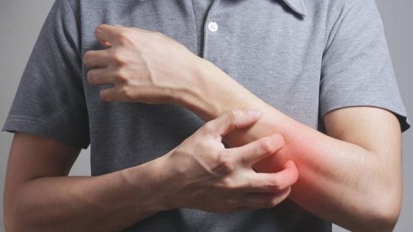 نصائح طبية مهمة للحفاظ على صحة الجلد في الصيف