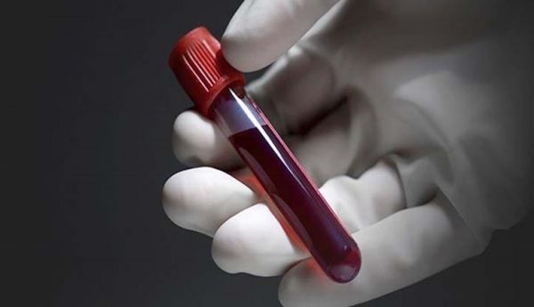 دراسة تحدد فئة الدم "الأكثر عرضة للإصابة بسكتة دماغية"