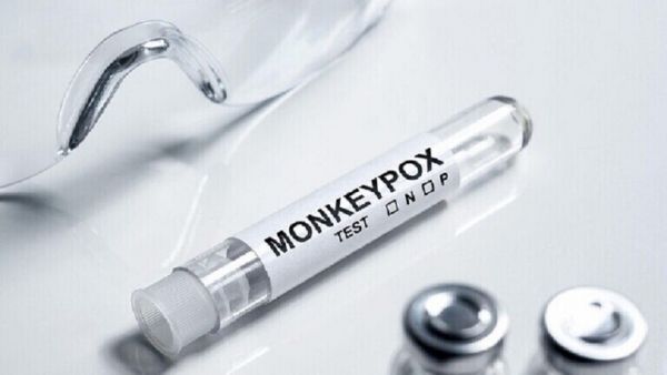 إصابات جديدة بجدري القردة في الصين