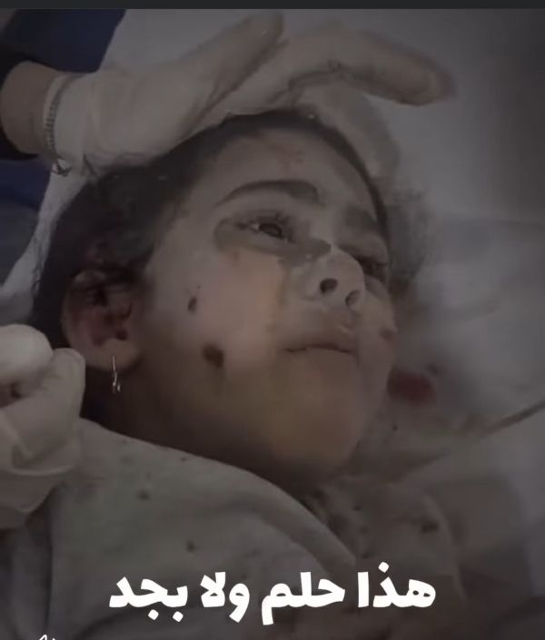 طفلة جريحة بغزة تسأل الطبيب: عمو.. هذا حلم ولّا بجد؟