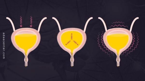 السلس البولي.. الأسباب وسبل العلاج