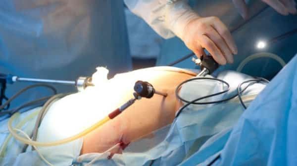 ما علاقة جراحات السمنة وانقطاع النفس الانسدادي بخطر الوفاة؟