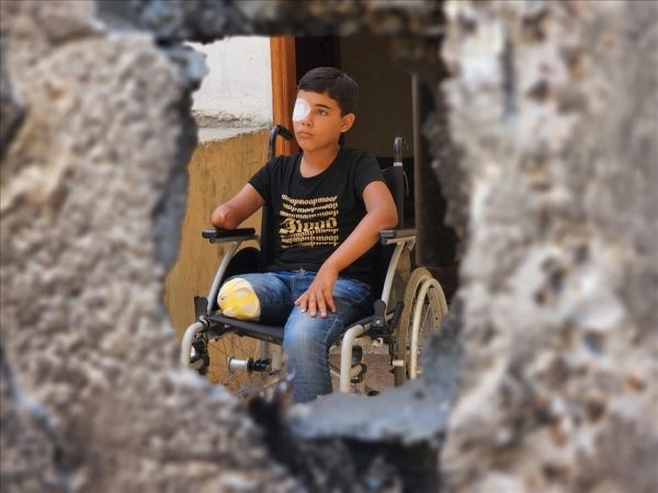 وحيد الغلبان.. طفل غزي غلبته الشظايا وغالب الإصابة بالأمل