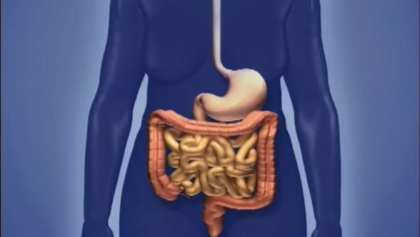 تعرف على الأعراض الرئيسية لسرطان الأمعاء
